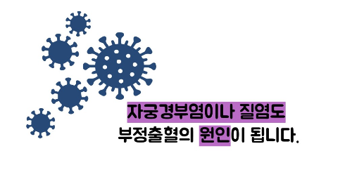 부정출혈 원인