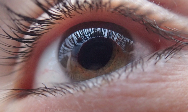 당뇨_백내장안과검사