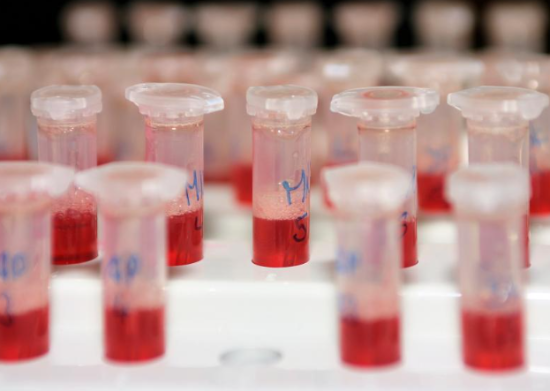 혈액검사