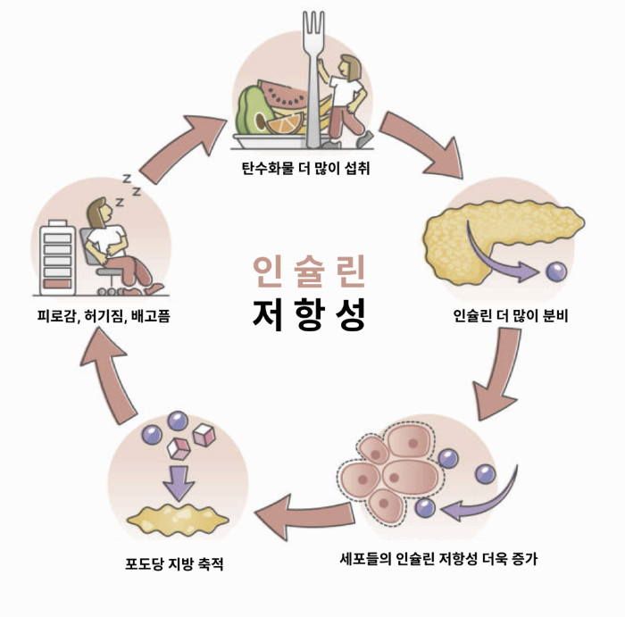 인슐린 저항성