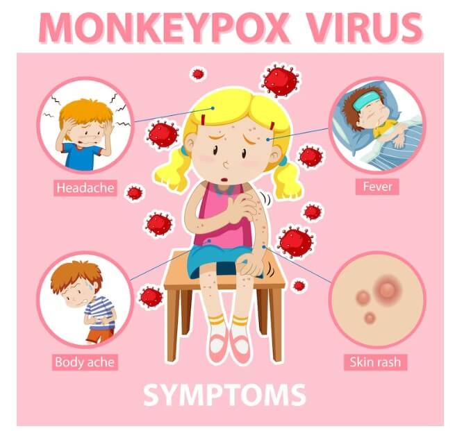 엠폭스 원숭이 두창 관련된 포스터입니다.