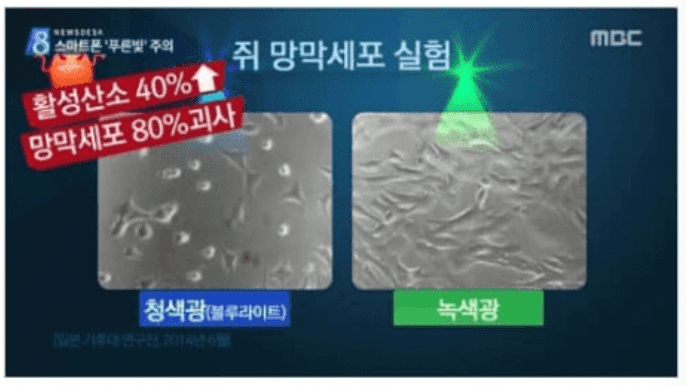 비문증 눈영양제