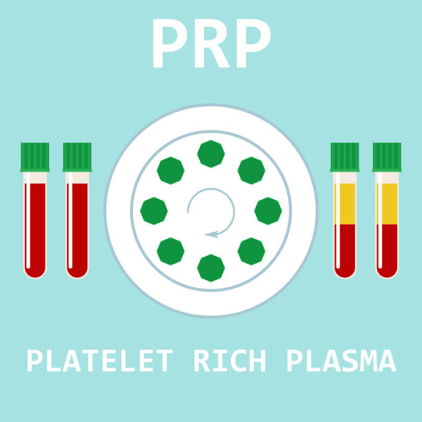 혈소판 수치 올리는 방법