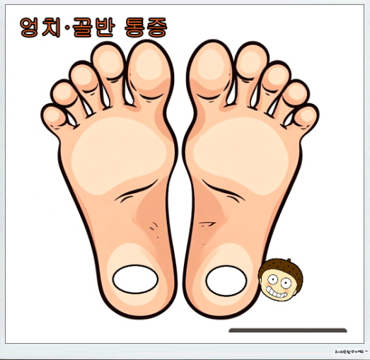 발바닥 바스 붙이는 위치_엉덩이,골반통증