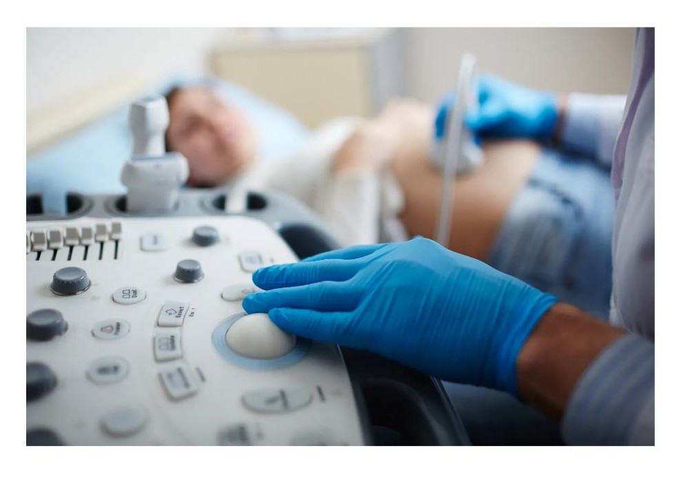 초음파 검사 기계 사진