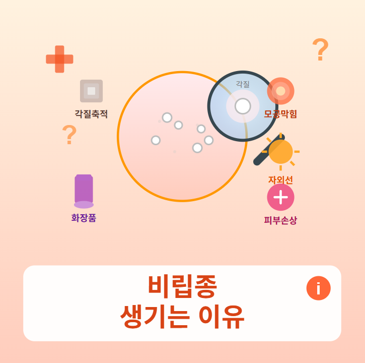 비립종 생기는 이유