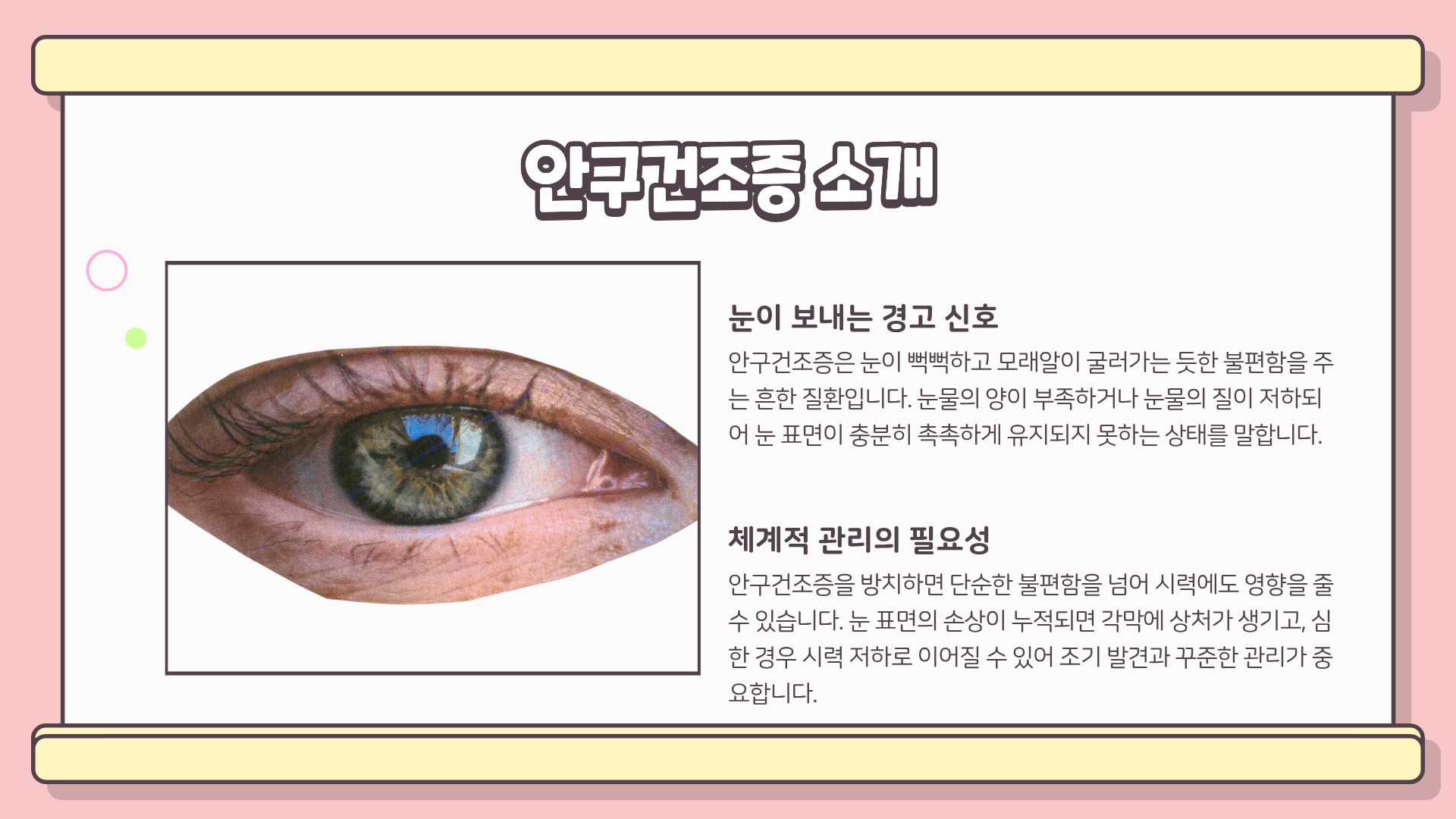 안구건조증 치료 | 안구건조증 증상 | 안구 건조증 민간요법 완전정복 가이드