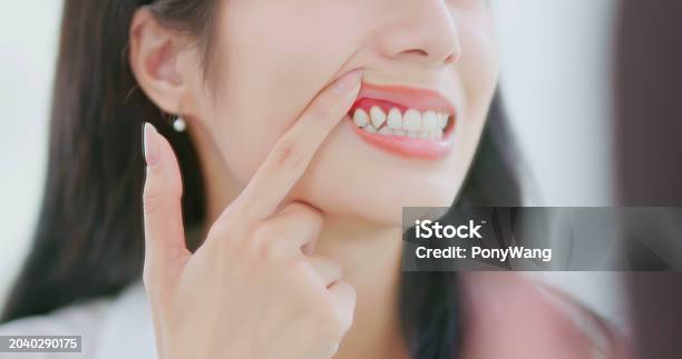 치주염-관련-사진