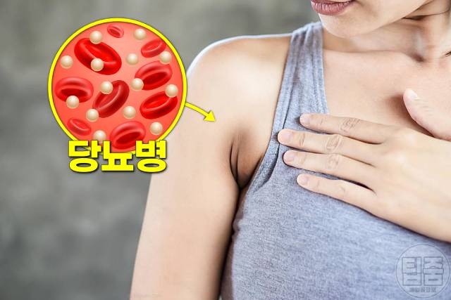 겨드랑이 까만색 착색 원인 당뇨병 겨드랑이 까만 이유