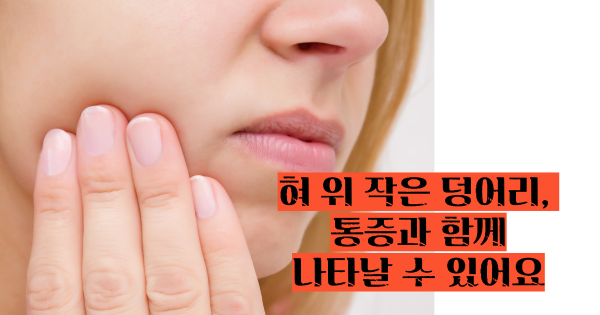 설암 초기증상
