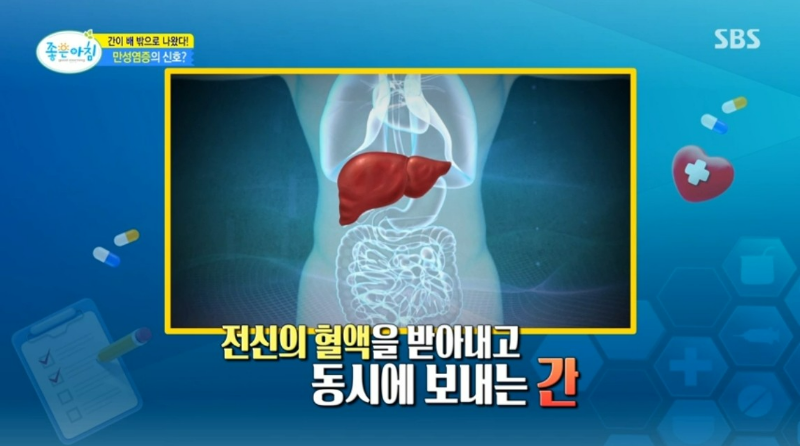 겨울 무기력 만성 염증 원인