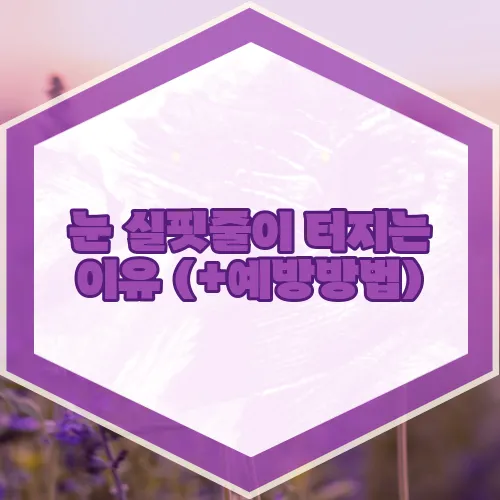 눈 실핏줄이 터지는 이유 (+예방방법)