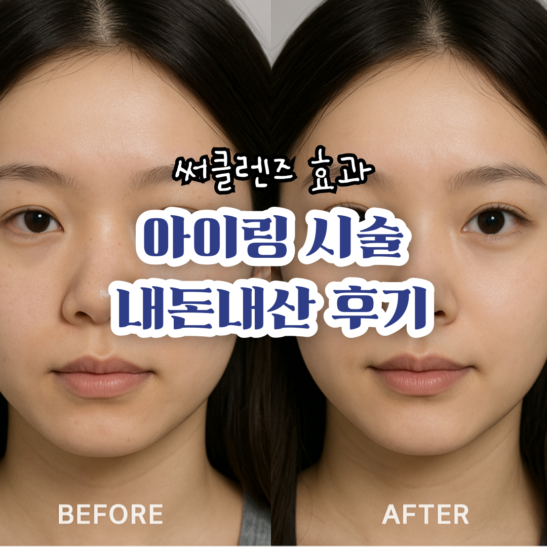 아이링-시술-후기-내돈내산