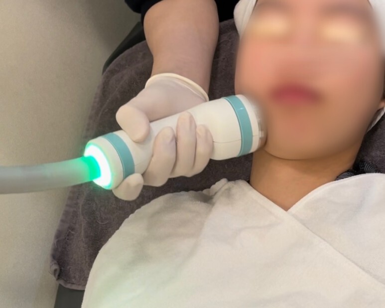 온다 리프팅 후기