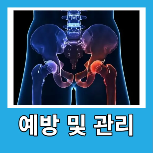예방 및 관리