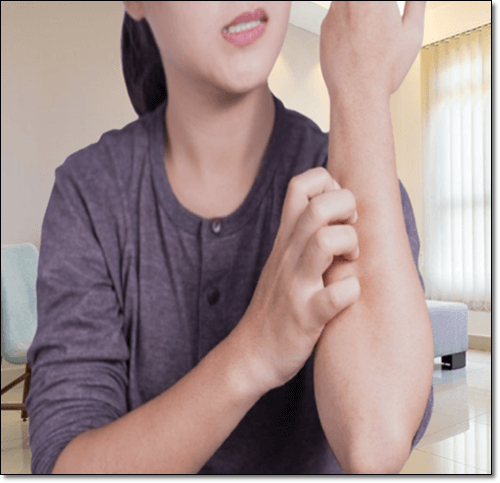 알레르기 증상이 있는 여성