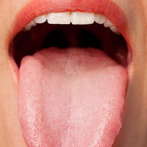 입안 염증, 수포, 피멍울 - 원인과 해결 방법