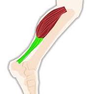종아리 근육 통증 원인