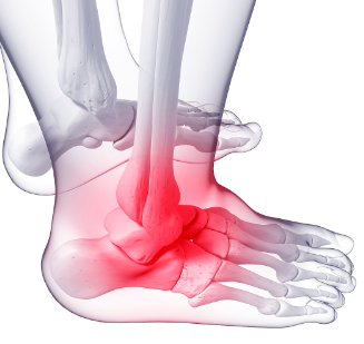 발목의 통증