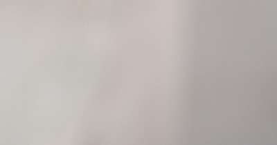 모공 각화증 원인 치료