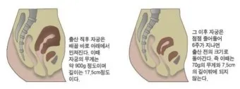 출산 후 산모에게 좋은음식 총정리_20
