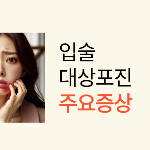 대상포진