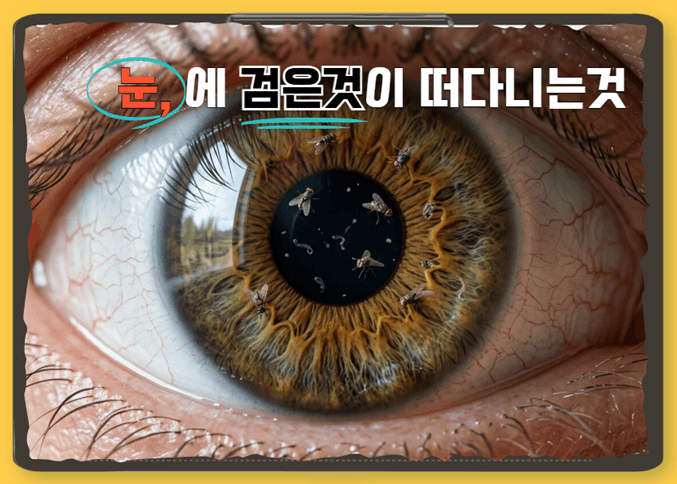 눈 검은것이떠다니는것