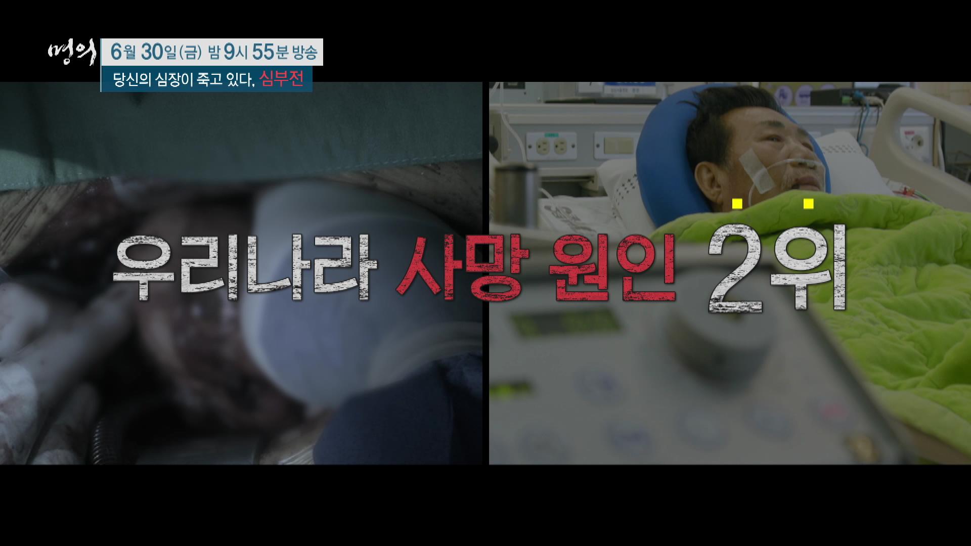당신의 심장이 죽고 있다, 심부전 원인, 진단기준, 증상, 치료 방법 삼성서울병원 순환기내과 최진오 교수 예약 추천