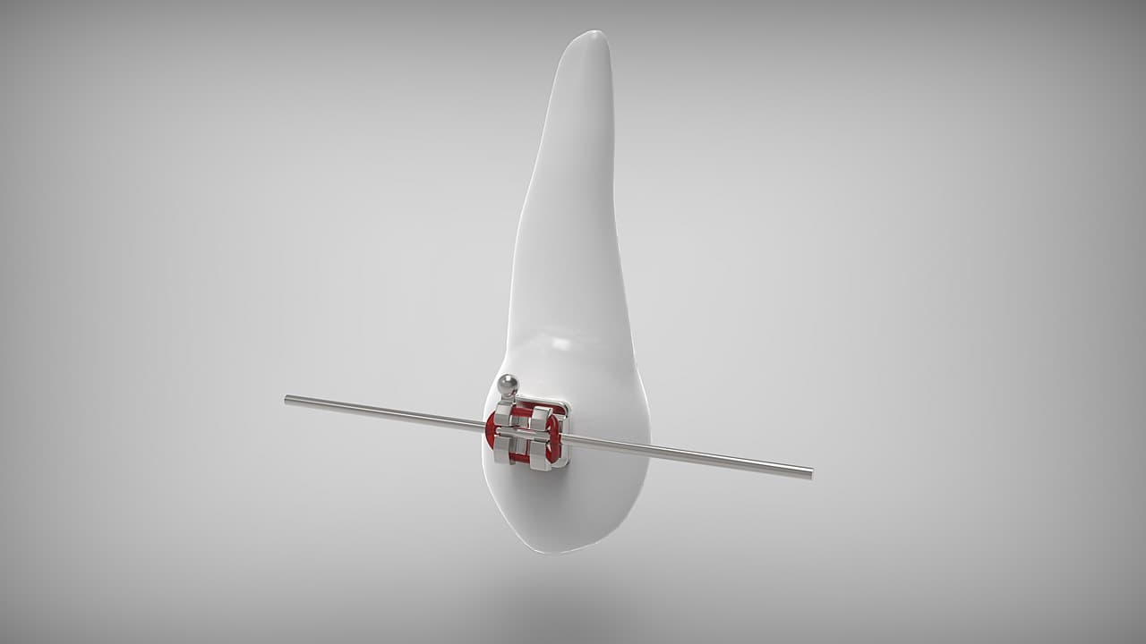 치아 교정과 수면의 관계