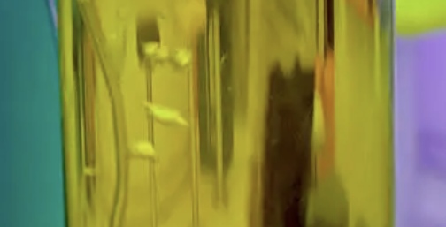 소변이 자주 마려운 증상 25