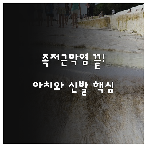 족저근막염 재발 방지를 위한 발바닥 ..