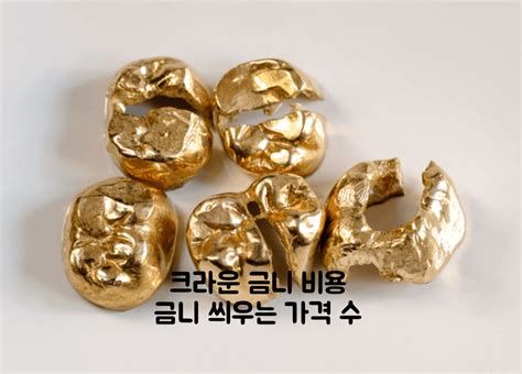 금니가격