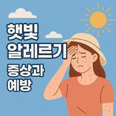 햇빛 알레르기 증상과 예방