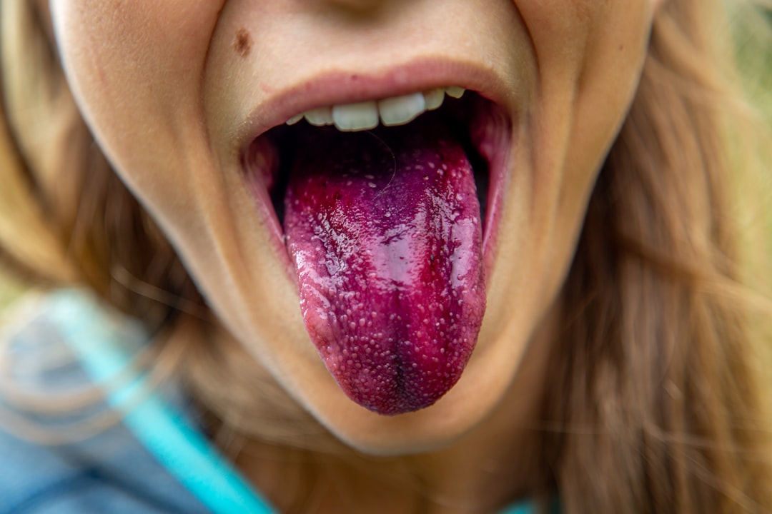 Mouth sore
