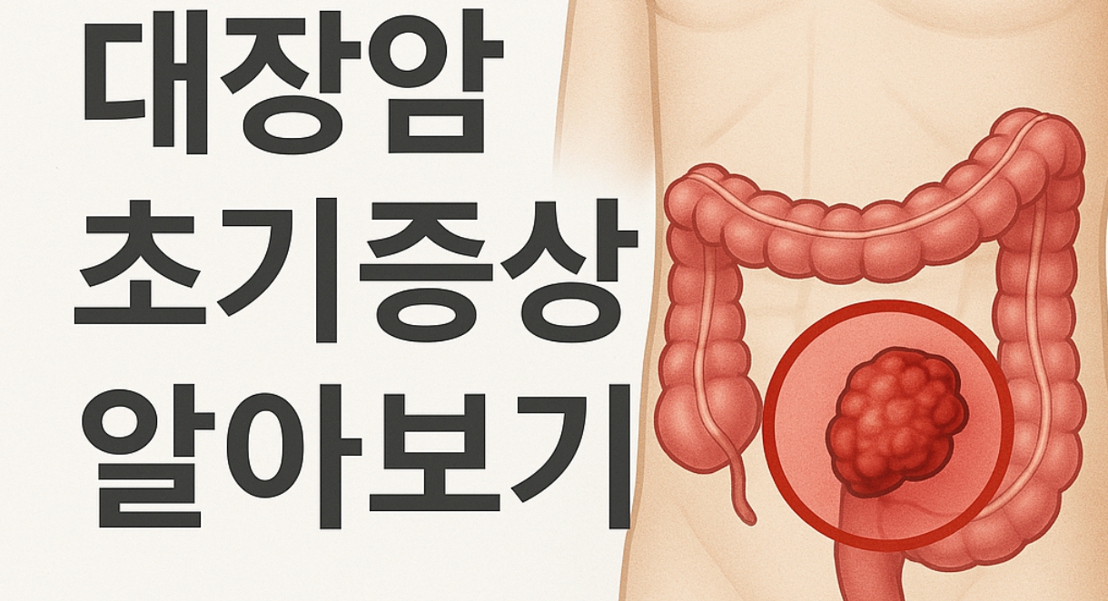 대장암 초기증상 알아보기