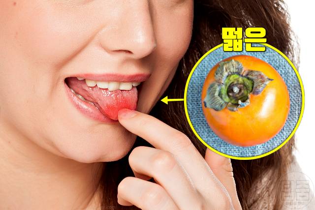 입이 떫은 증상 혀가 화끈거려요 구강작열감증후군 원인