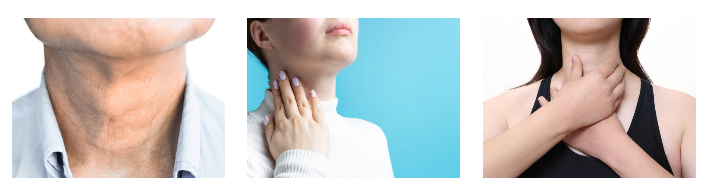 대한민국에서 갑상선암 치료 가장 잘하는 병원 TOP 15