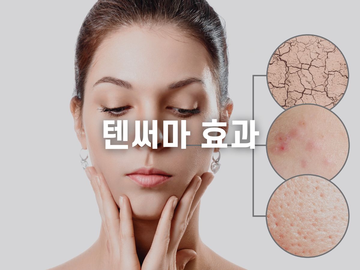텐써마 효과