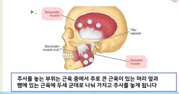 귀하신몸-턱관절