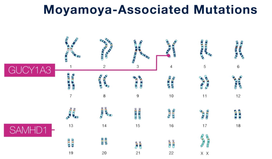 모야모야병 증상