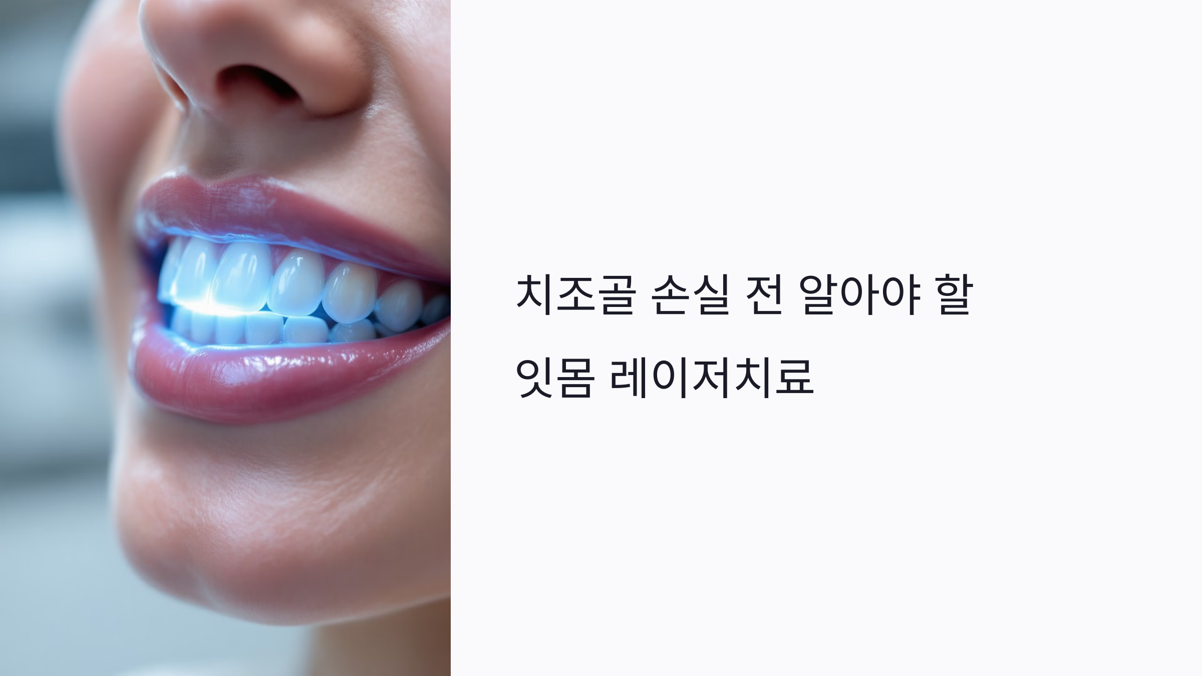 치조골 손실 전 알아야 할 잇몸 레이저치료 방법과 효과