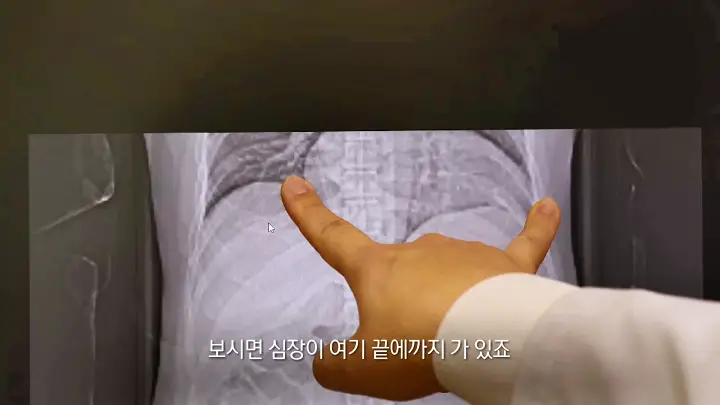 KBS 생로병사의 비밀 818회 급성 심근경색 심부전 협심증 심혈관 질환자를 위한 심장 재활 효과