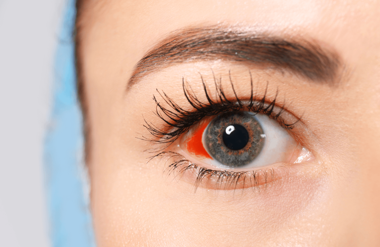 눈 실핏줄 터짐 원인