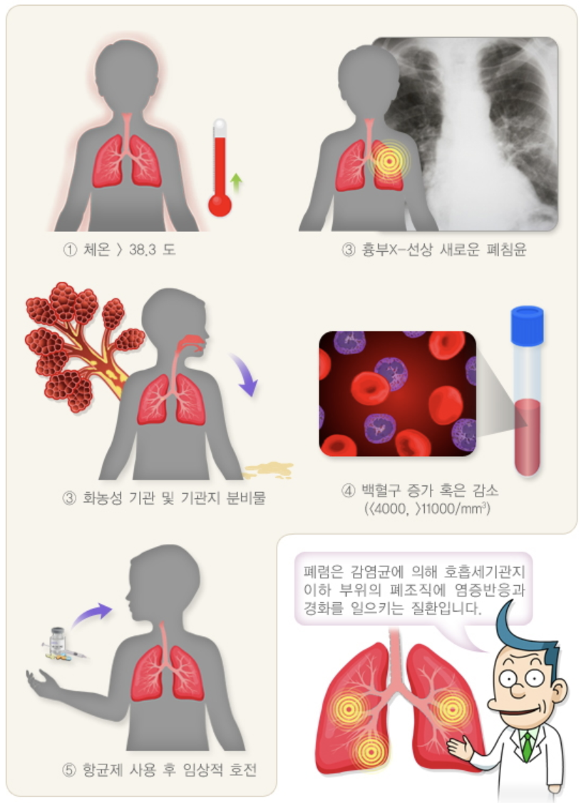 폐렴이란