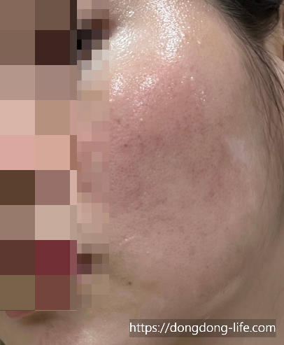 중계의원 기미 리뷰