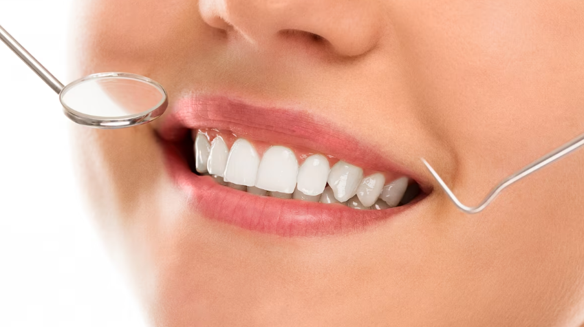 4. 치주질환 예방방법