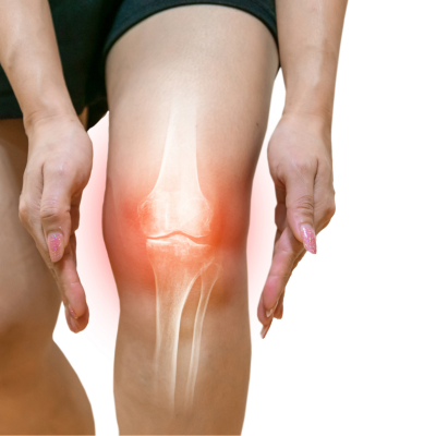 관절 건강에 도움을 주는 보스웰리아