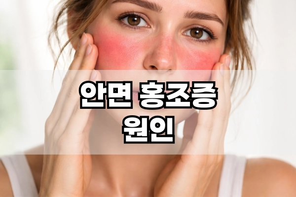 안면 홍조증 원인