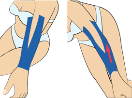 팔의 나른함(무거운 느낌이 있을 때)