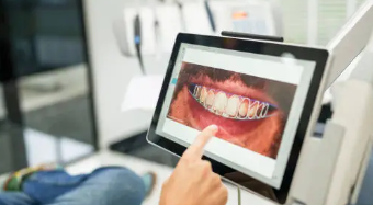 임플란트 구조, 장단점, 관리법 총 정리 (2025 최신)